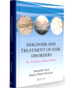 Diagnosis and Treatment of Hair Disorders An Evidence Based Atlas