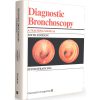 Diagnostic Bronchoscopy a teaching manual
