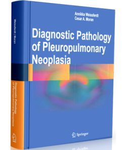 Diagnostic Pathology of Pleuropulmonary Neoplasia