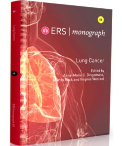 ERS - monograph 2015 - Lung Cancer