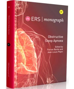 ERS - monograph 2015 - Obstructive Sleep Apnoea