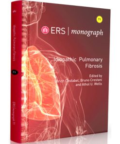 ERS - monograph 2016 - Idiopathic Pulmonary Fibrosis