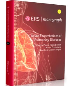 ERS - monograph 2017 - Acute Exacerbations of Pulmonary Diseases