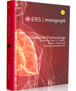 ERS - monograph 2017 - Interventional Pulmonology