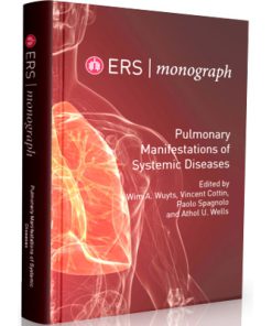 ERS - monograph 2019 - Pulmonary Manifestations of Systemic Diseases