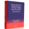 Epileptic Seizures and the EEG: Measurement, Models, Detection and Prediction