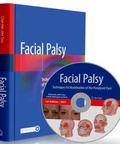 Facial Palsy Techniques for Reanimation of the Paralyzed Face