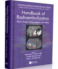 Handbook of Radioembolization