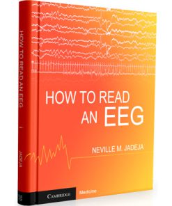 How to Read an EEG