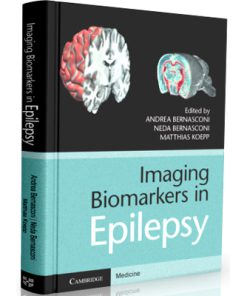 Imaging Biomarkers in Epilepsy