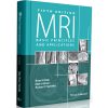 MRI Basic Principles and Applications