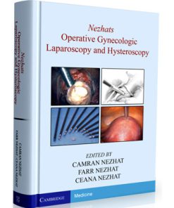 Nezhat's Operative Gynecologic Laparoscopy and Hysteroscopy: Principles and Techniques