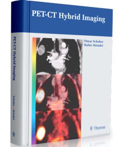 PET-CT hybrid imaging