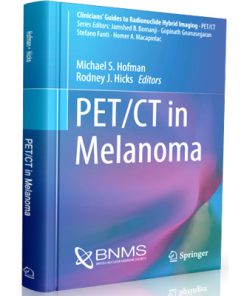 PET CT in Melanoma
