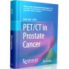 PET CT in Prostate Cancer
