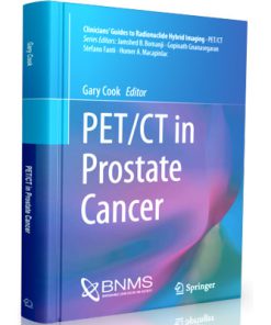 PET CT in Prostate Cancer