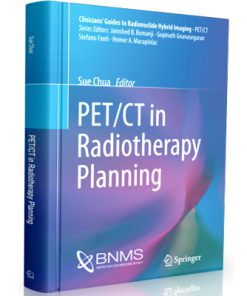 PET CT in Radiotherapy Planning