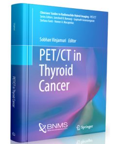 PET CT in Thyroid Cancer
