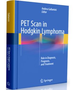 PET Scan in Hodgkin Lymphoma: Role in Diagnosis, Prognosis, and Treatment