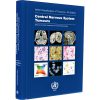 WHO Classification of Tumours Central Nervous System Tumours
