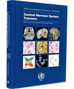 WHO Classification of Tumours Central Nervous System Tumours