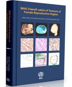 WHO Classification of Tumours of the Female Reproductive Organs