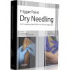 Trigger Point Dry Needling: An Evidence and Clinical-Based Approach