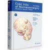 Color Atlas of Microneurosurgery Vol 1 : Intracranial Timors