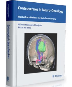 Controversies in Neuro-Oncology: Best Evidence Medicine for Brain Tumor Surgery