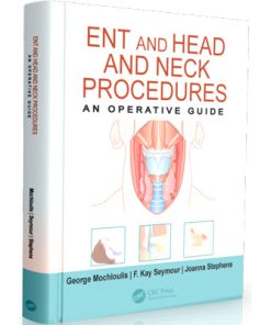 ENT and Head and Neck Procedures: An Operative Guide