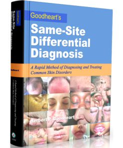 Goodheart's Same-Site Differential Diagnosis: A Rapid Method of Diagnosing and Treating Common Skin Disorders