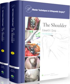 Master Techniques in Orthopaedic Surgery : The SHOULDER