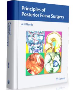 Principles of Posterior Fossa Surgery