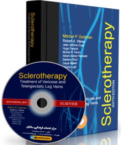 Sclerotherapy Treatment of Varicose and Telangiectatic Leg Veins