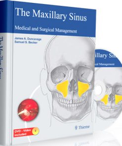 The Maxillary Sinus Medical and Surgical Management