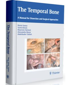 The Temporal Bone: A Manual for Dissection and Surgical Approaches