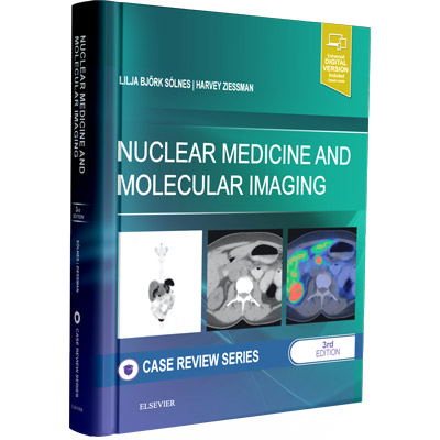 Nuclear Medicine and Molecular Imaging: Case Review series 3rd Edition ...