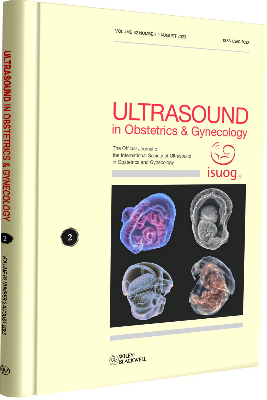 Ultrasound in Obstetrics & Gynecology: isuog 2023 (Vol 62 - N2